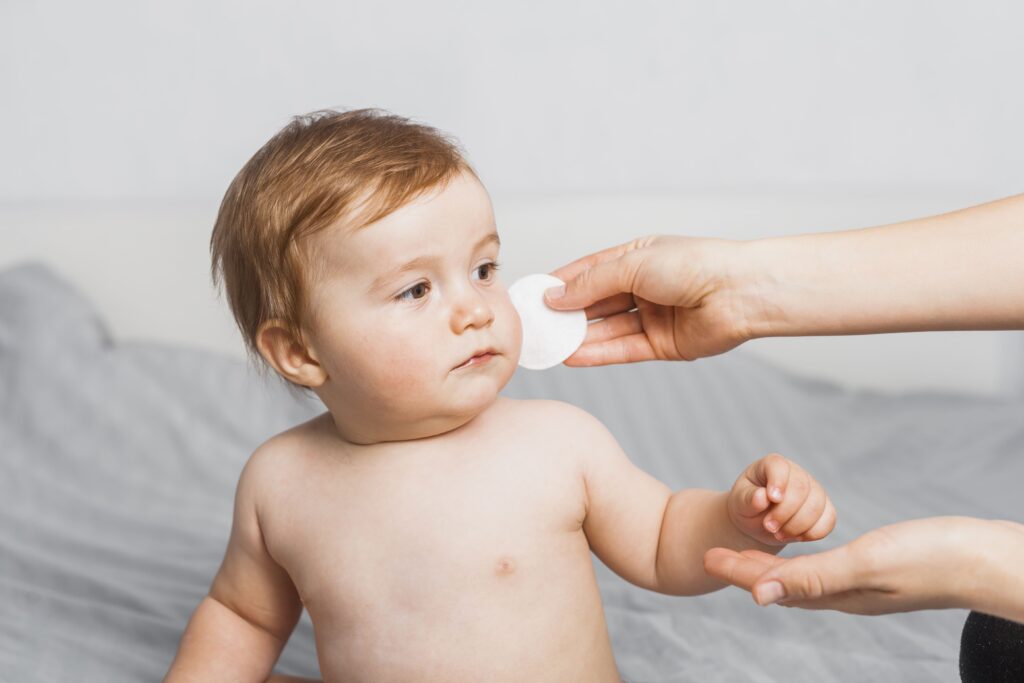 Remedies for Baby Eczema